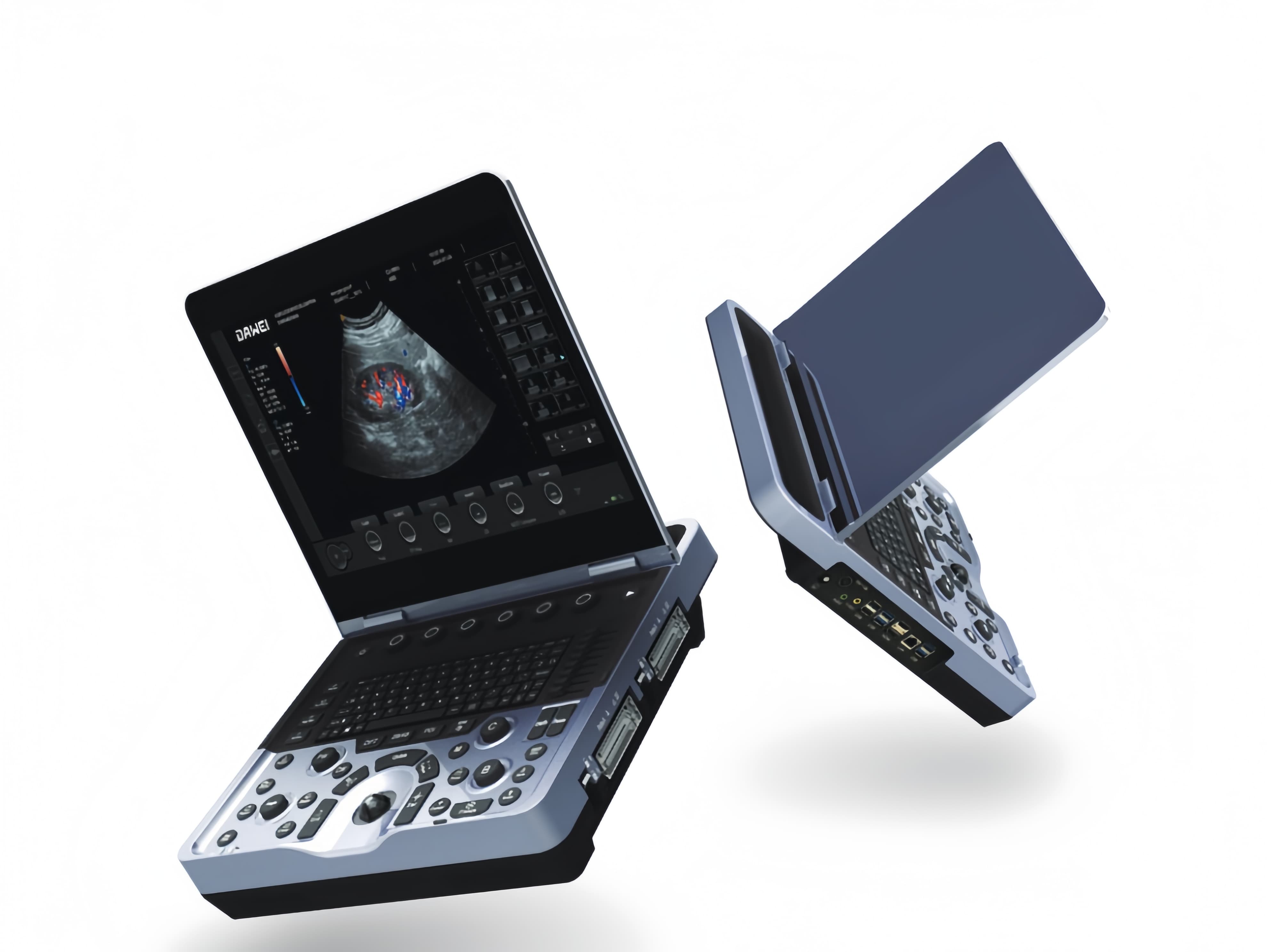 ラップトップカラーUltrasound Machine_image_Repair _ 17472800086 12