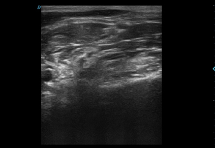 Musculoesquelético (MSK)