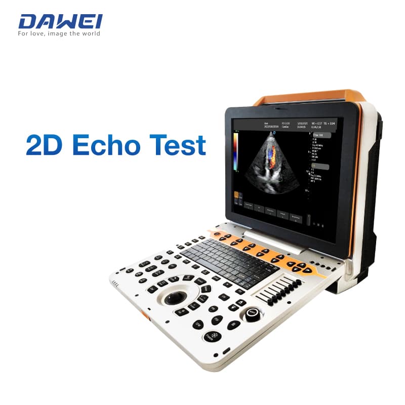 3D 4Dポータブルカラードップラー超音波マシン