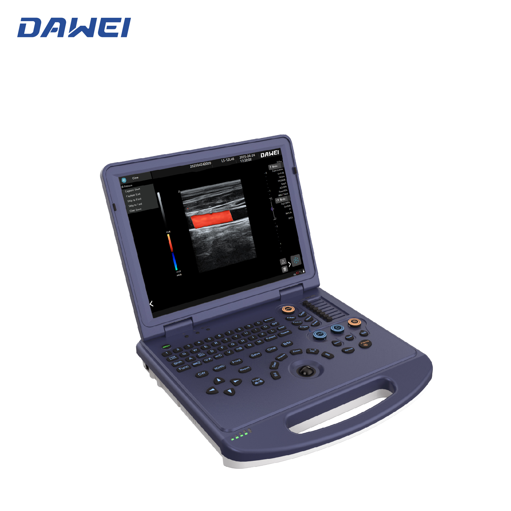 ဈေးနှုန်းချိုသာသော Laptop Color Ultrasound စက်