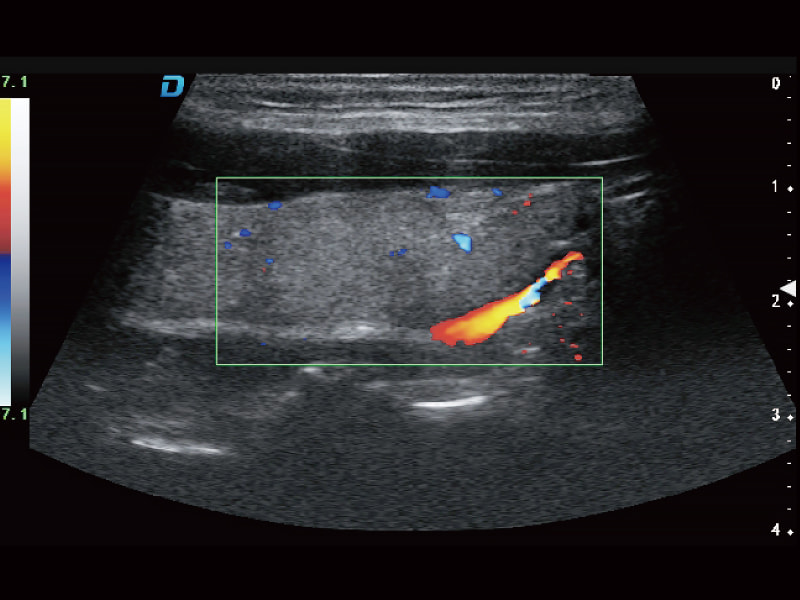 Imagerie trapézoïdale