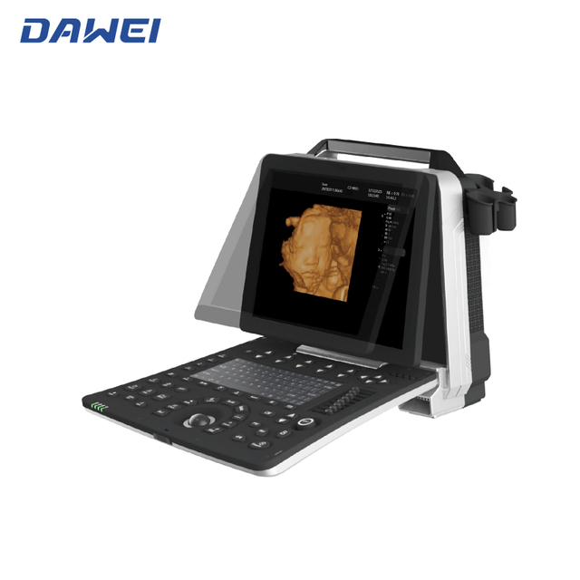Cheap Portable 3D 4D Ultrasound Machina