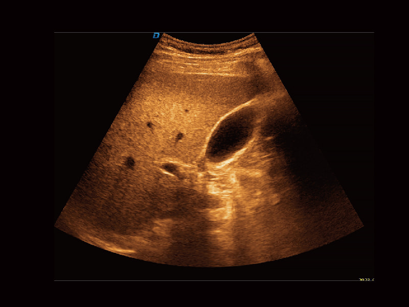 Imagerie de contraste