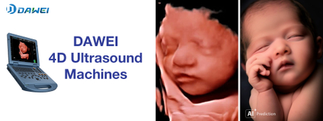 Fetal Imaging.jpg ရှိ 4D Ultrasound စက်များနှင့် AI တို့၏ ဆင့်ကဲဖြစ်စဉ်