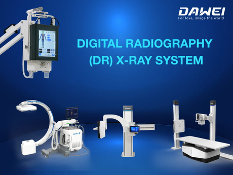 Apa itu Sistem Sinar-X Radiografi Digital.jpg