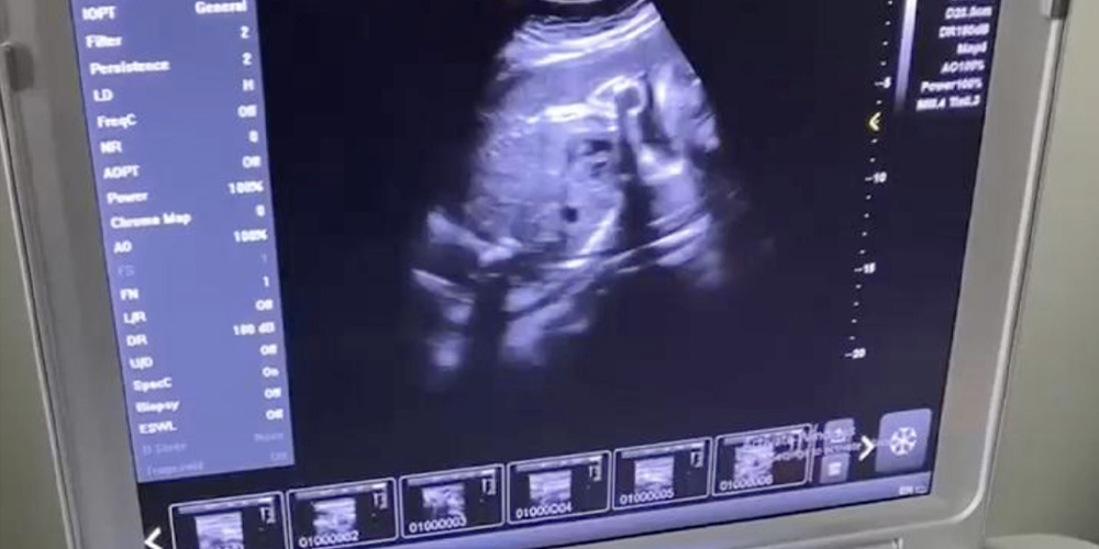 Makin&euml; me ultratinguj Dw-L3 Laptop-Imazhe fetale