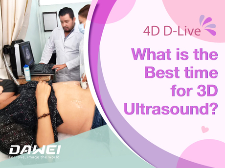 Care este cel mai bun moment pentru ultrasunete 3D?-800-600.jpg