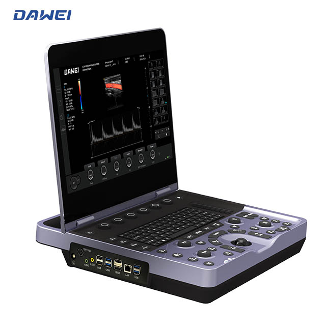 Cần b&aacute;n m&aacute;y si&ecirc;u &acirc;m m&agrave;u POCUS