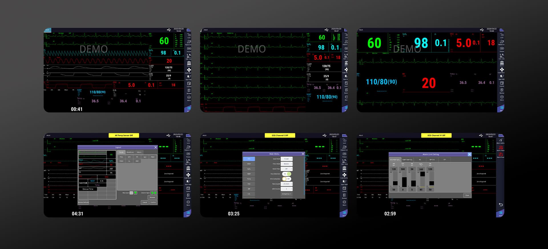 Recursos modulares do monitor de paciente