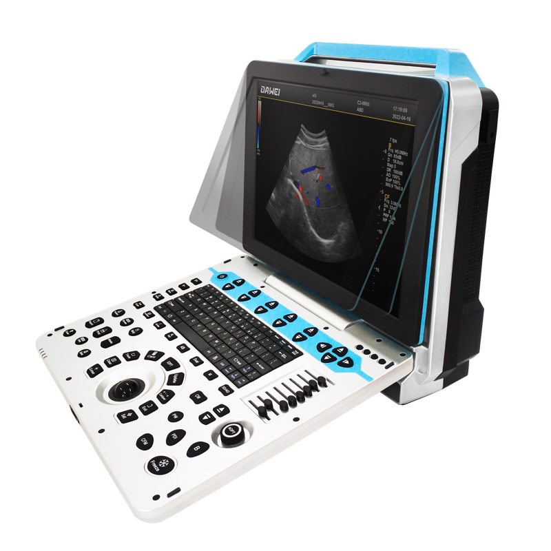 Mesin USG Warna OB&GYN 4D