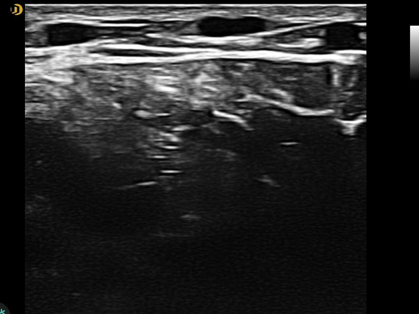 Linéaire, Membre inférieur