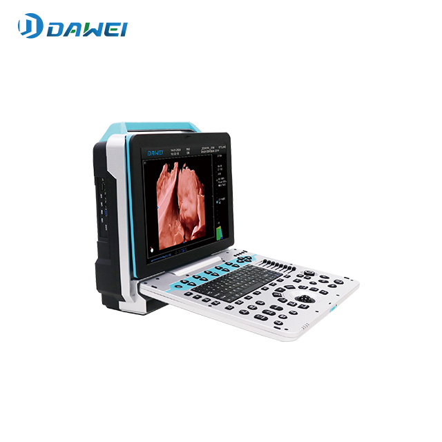 ເຄື່ອງ Ultrasound 4D ແບບພົກພາສໍາລັບສຸຂະພາບຂອງແມ່ຍິງ