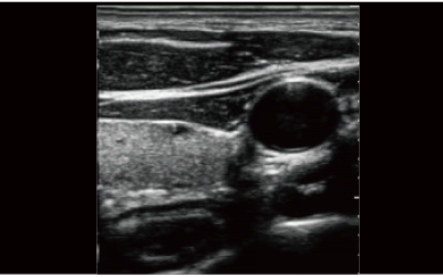 التصوير المركبة المكانية