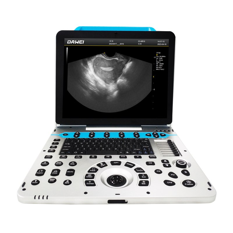 Mesin USG Warna OB&GYN 4D