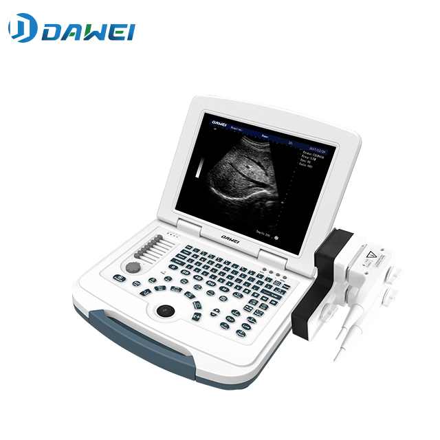 Նոթբուքի տեսակը B/W ուլտրաձայնային համակարգ ցածր գնով