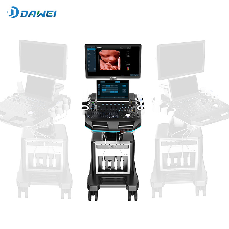 Trolley 4d ultralydsmaskine til OB GYN