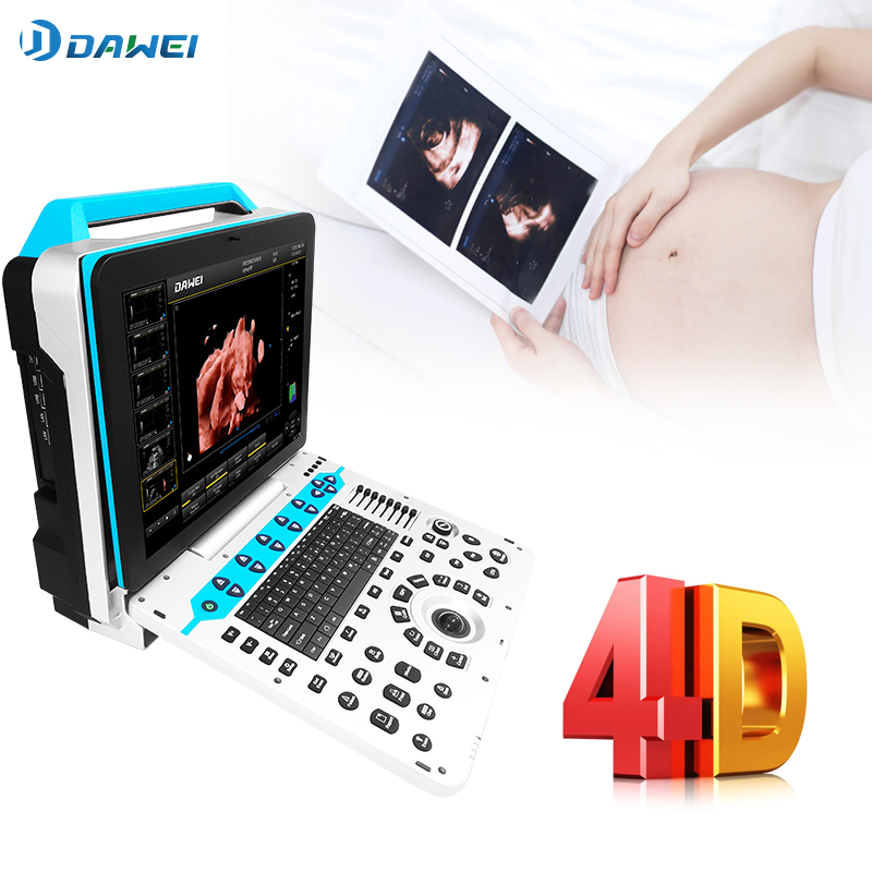 OB & Gyn 4D Color Ultrazvuk