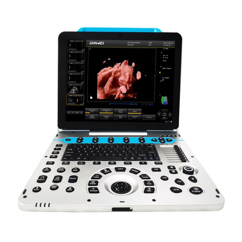 Mesin USG Warna OB&GYN 4D