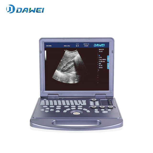 PW 기능을 갖춘 휴대용 흑백 초음파 기계