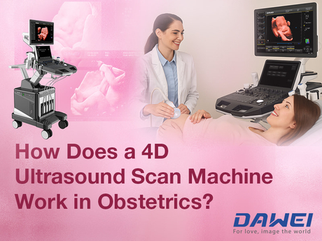 Hvordan fungerer en 4D ultralydsscanningsmaskine i obstetrik-800-600.jpg