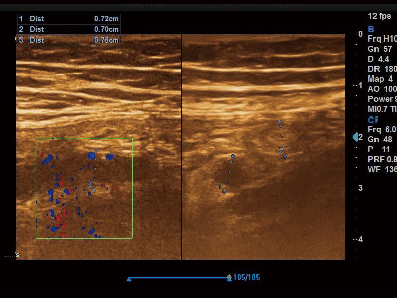 Musculo-squelettique