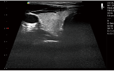 التصوير شبه المنحرف