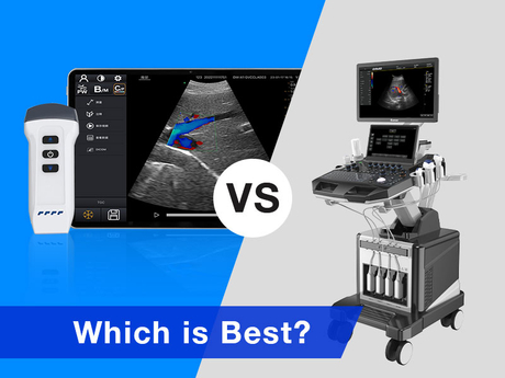 240905-қолды ультрадыбыстық дәстүрлі ultrasound800-600.jpg