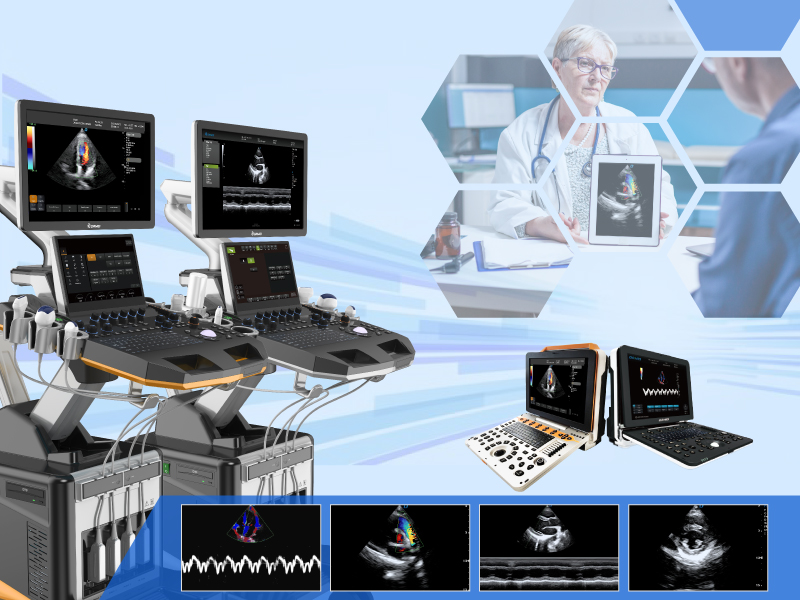 Quomodo Cordis Ultrasound Machina Opera Et quare Est Essentiale pro Cardiac Care-800-600.jpg