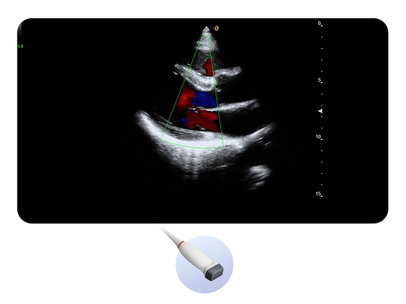 Cardiolog&iacute;a